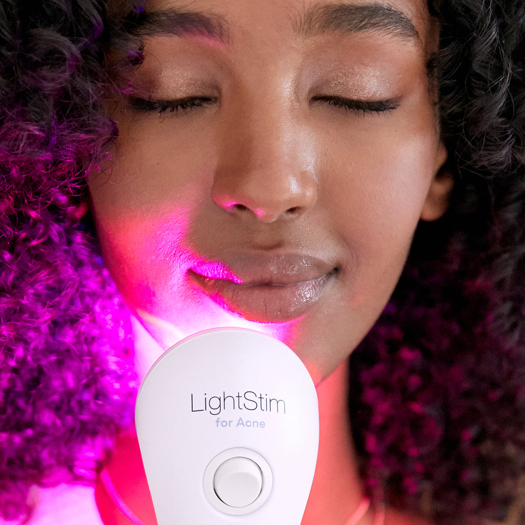Handheld Light therapy for Acne